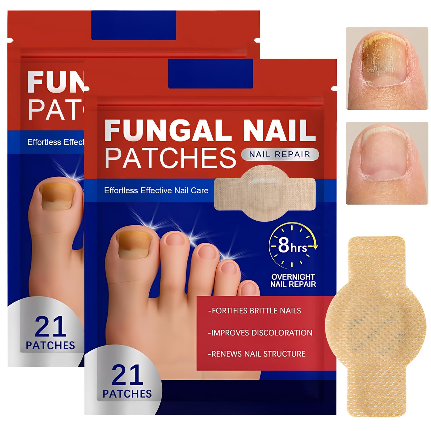 Fungal Nail Patches, 42 Pcs Fungal Nail Repair Patches, Nail Fungus Treatment for Toenail Anti Fungal Nail Treatment