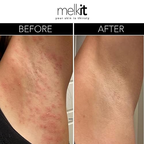 Miniatura 2 de Body Melk Crema corporal natural, hidratación de absorción rápida para pieles secas o sensibles, calma la piel sensible, las erupciones y la