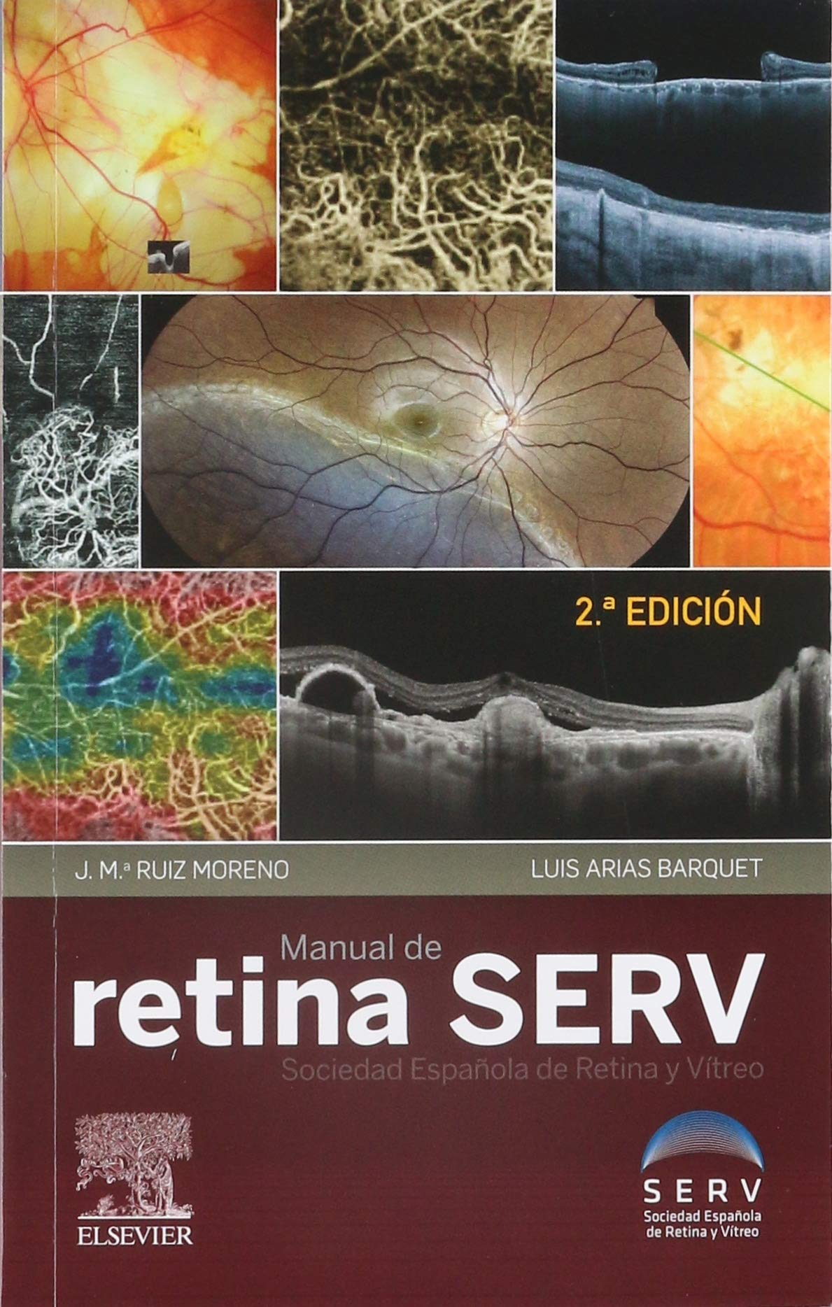 Manual de retina SERV (2ª ed.)