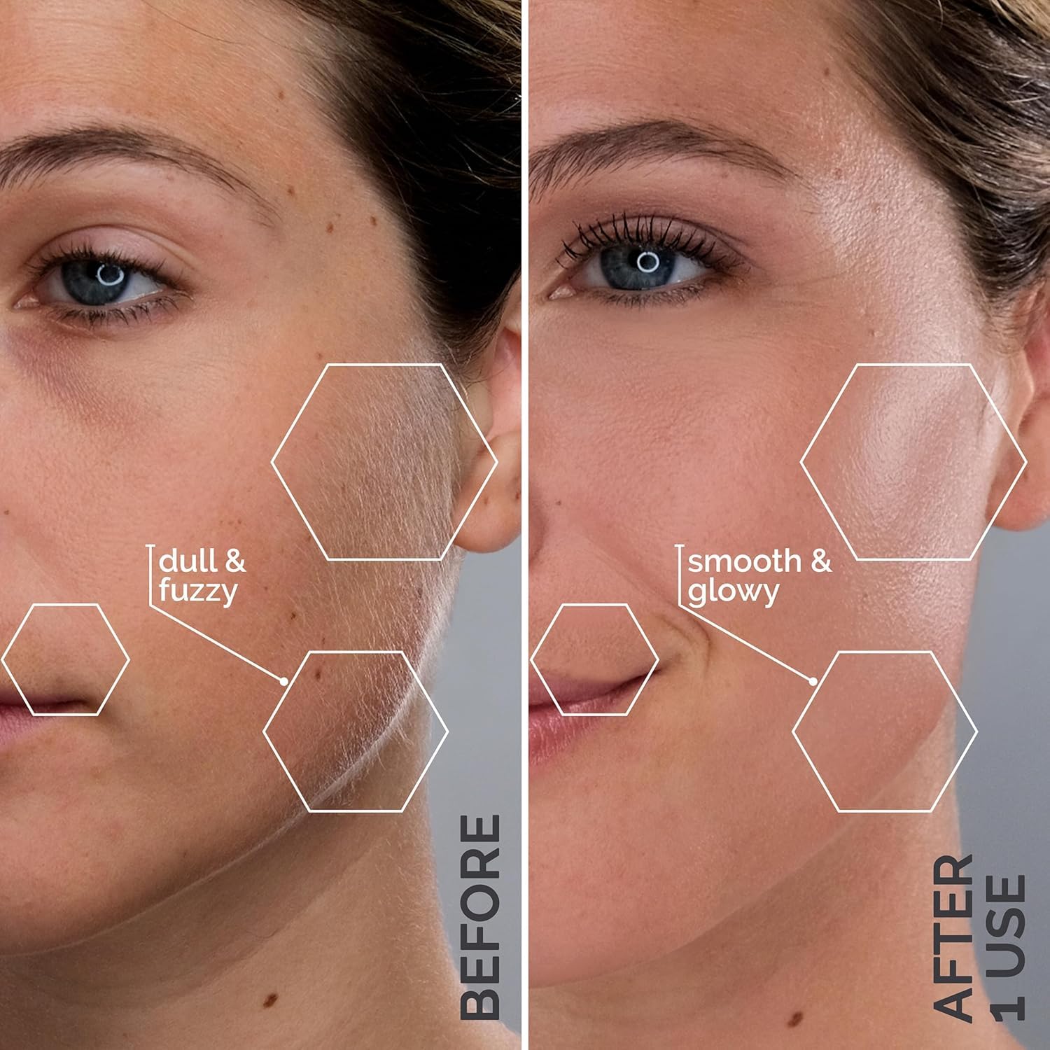 SPA SCIENCES - Rasoio Dermaplane brevettato SIMA per donne - Esfoliazione facciale 2 in 1 indolore e depilazione peluria pesca - anti-età - 3 velocità - ricaricabile - trattamento 7 settimane