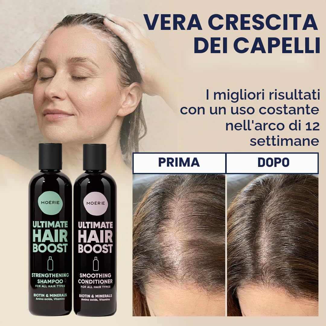 Moérie shampoo ristrutturante balsamo volumizzante anticaduta, prodotti per crescita capelli con ingredienti naturali, oltre 100 ingredienti attivi per capelli folti, lunghi e splendenti, 4 x 250 ml