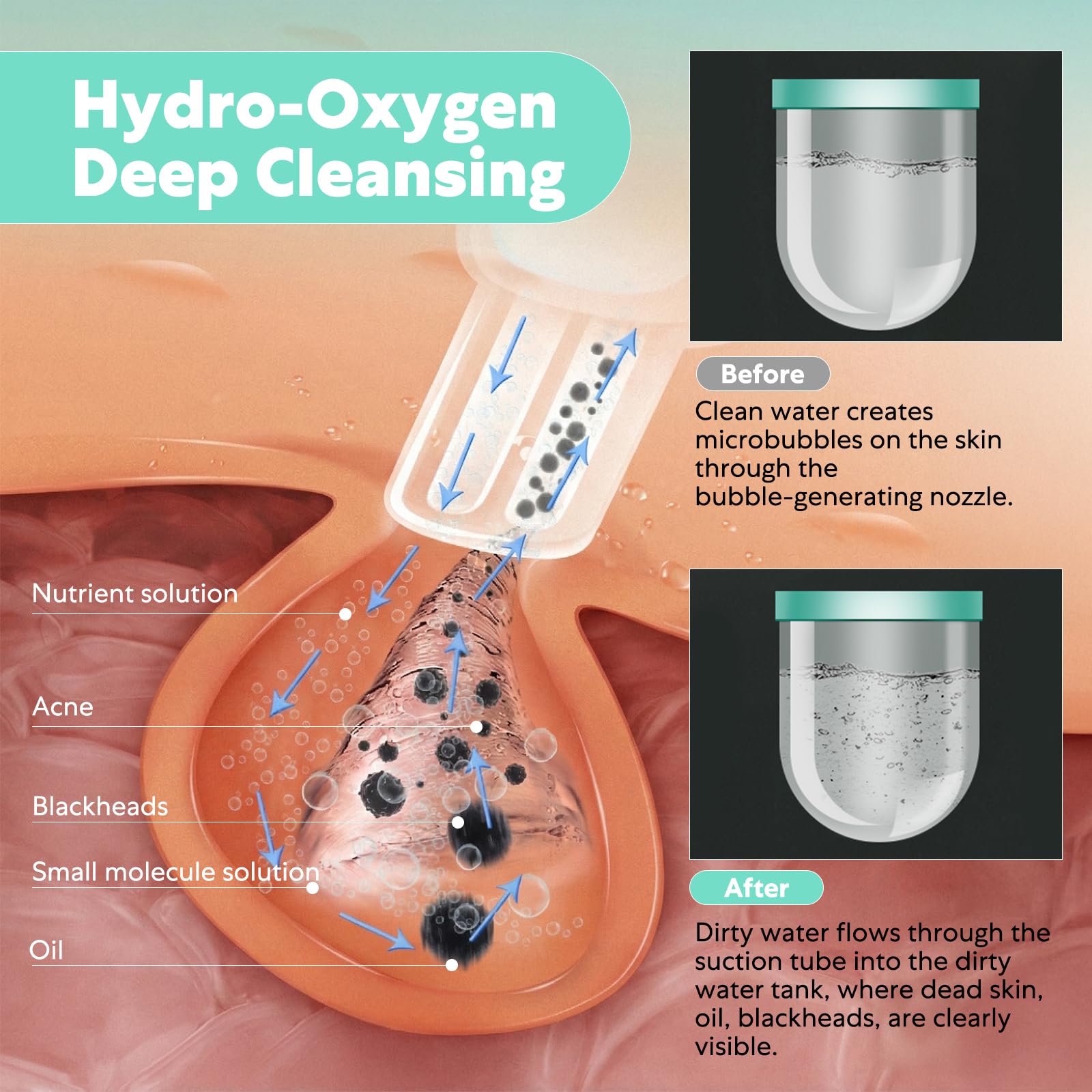 AquaFacial Appareil de nettoyage de la peau multifonction ménage avec oxygène de l'eau, 5 niveaux d'aspiration et 10 embouts – Appareil de nettoyage en profondeur avec micro-bulles pour la maison