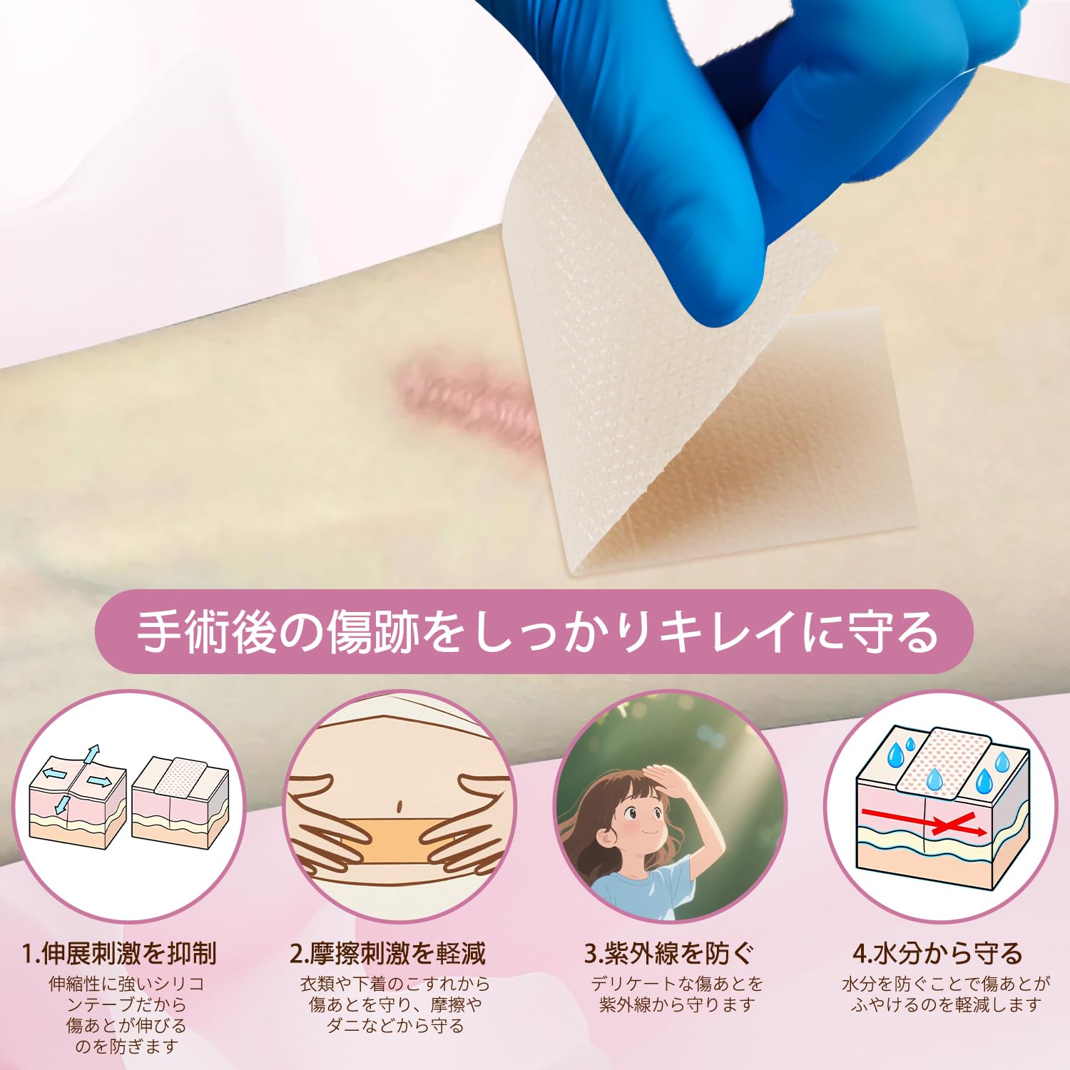 新品未使用 MARUKO ミモア　4点セット※外箱に傷、テープ跡あり Amazon.co.jp: 「増量版」傷跡ケアテープ 帝王切開 傷テープ 「皮膚科