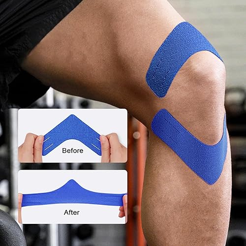 Miniatura 4 de Cinta de kinesiología, adhesivo de apoyo muscular, cinta elástica atlética deportiva, terapia de recuperación, tipo V para rodillas, hombros, alivio