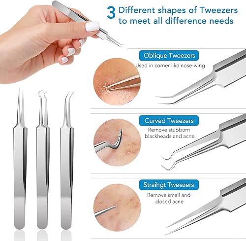 Miniatura 2 de Removedor de puntos negros, kit de herramientas para reventar espinillas, manchas, puntos blancos, eliminación de acné y zit, herramientas