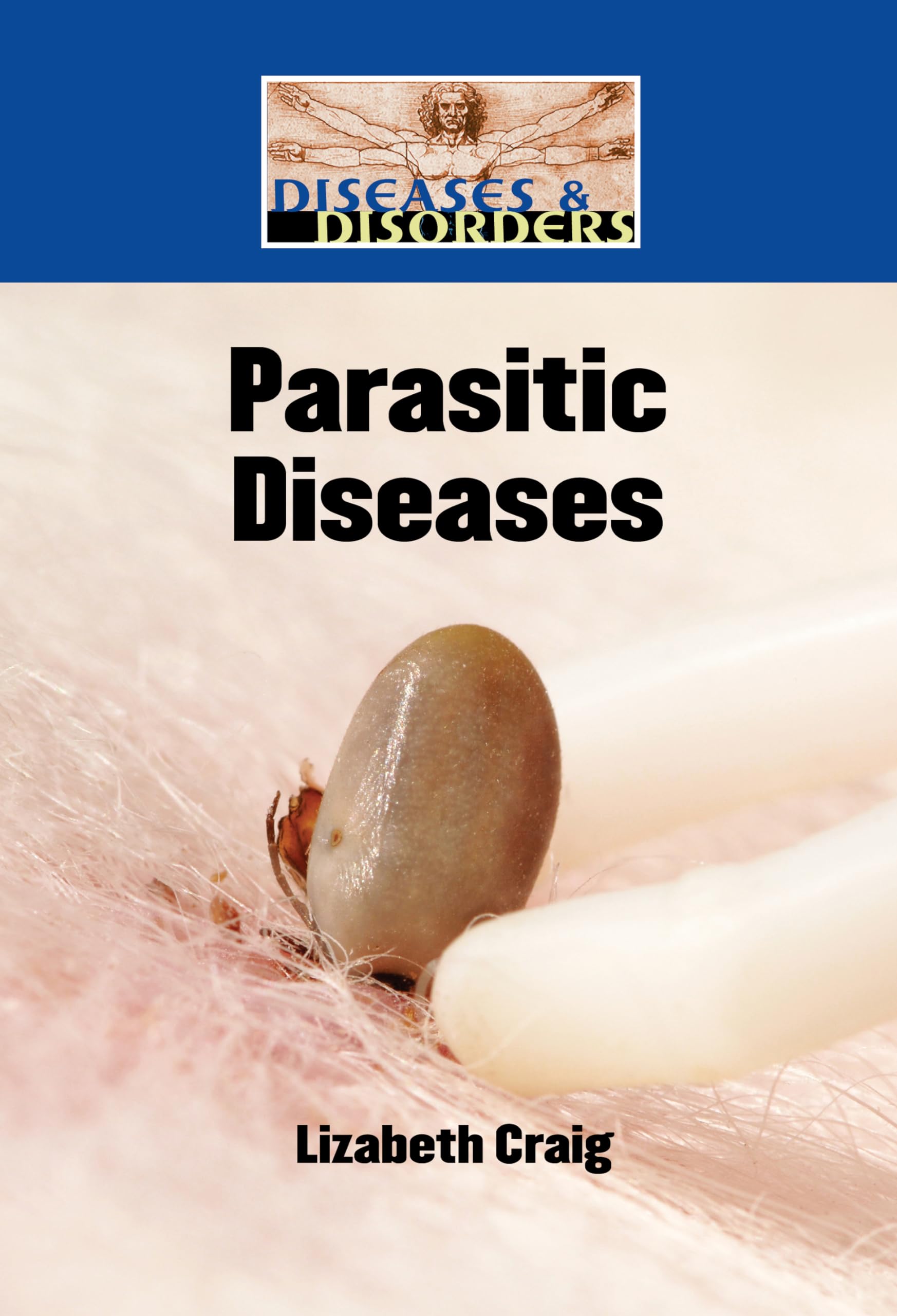 Buy Parasitic Diseases (Diseases & Disorders) — BookShops.in
