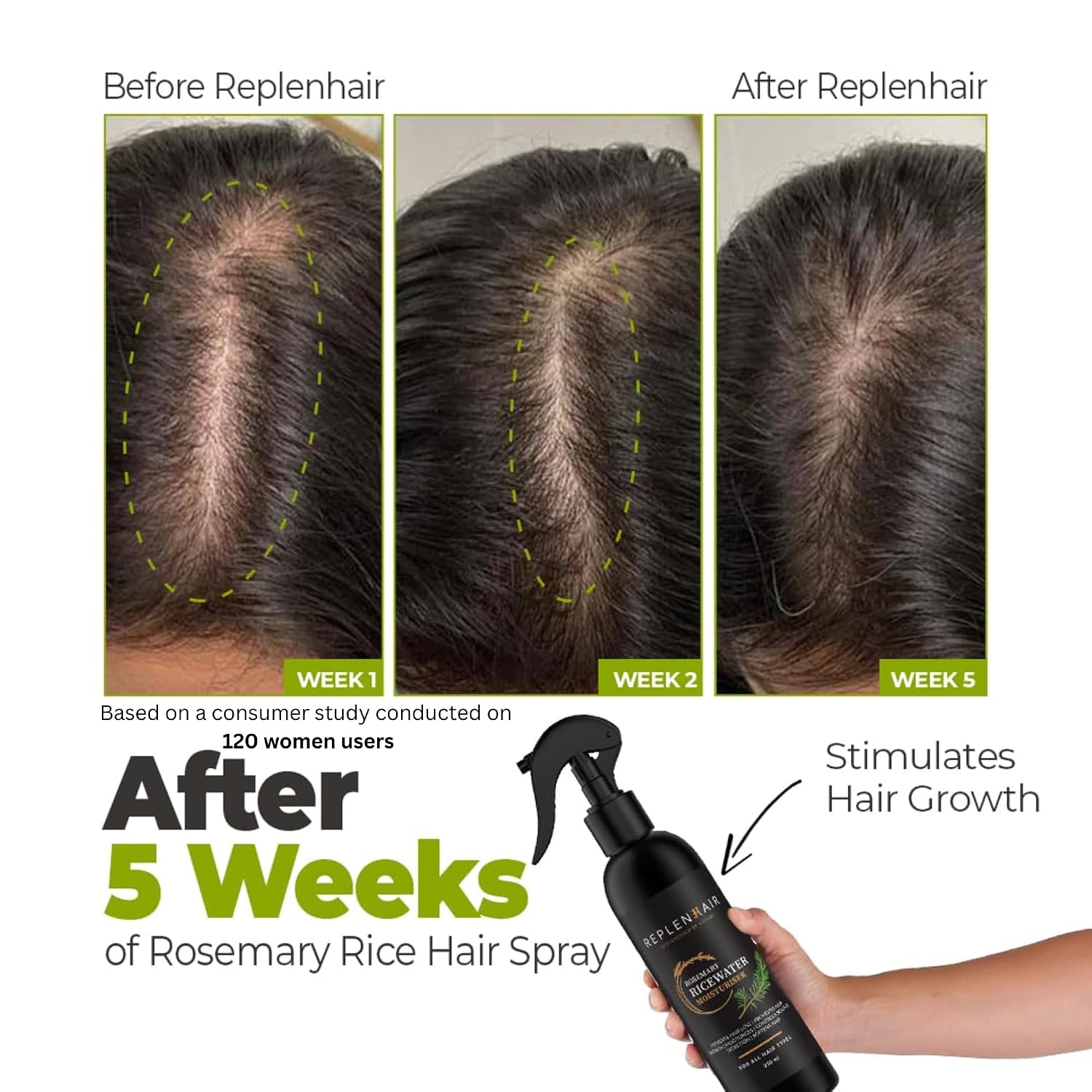 Rice and Rosemary Water Spray for Hair Growth | Serum and Leave-in Conditioner with Rosemary Oil & Fermented Rice Water for Hair Growth | Detangler & Scalp Toner for Thicker, Stronger Hair