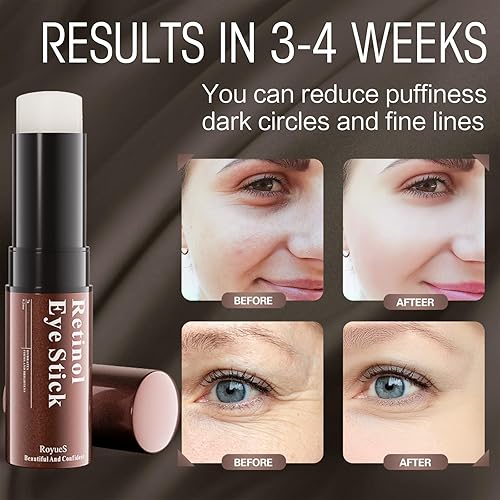 Miniatura 2 de Retinol Eye Stick, Eye Balm Glow Skin Care for Dark Circles and Puffiness Under Eye Cream Anti Aging for Wrinkles Brightening Eye Cream for Bags