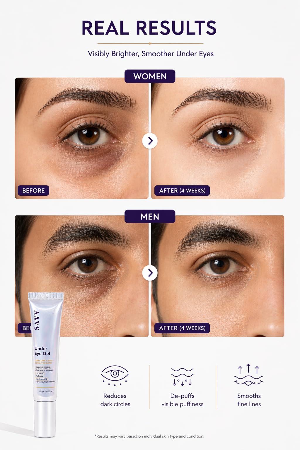 SAYY Under Eye Gel for Dark Circles, Puffiness and Fine Lines, with Caffeine, Niacinamide and Matrixyl® 3000, 15 gm 2