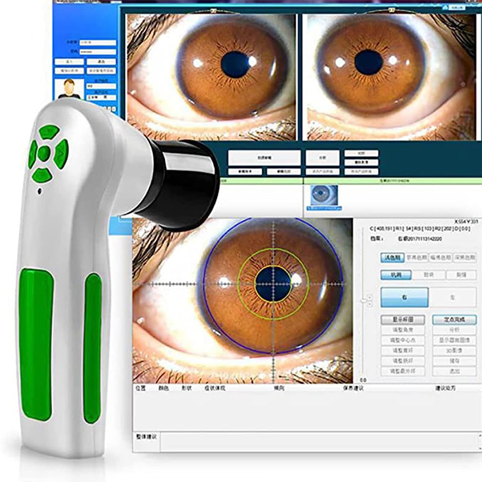 Caméra iridologique, détecteur d'iris Portable Interface USB2.0, Appareil Photo Analyse de l'iris USB Haute résolution à 12 MP, avec des logiciels d'analyse Gratuite Iris HD 30x
