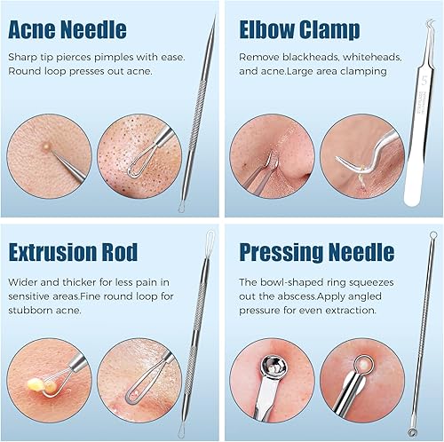 Miniatura 2 de Kit de herramientas para eliminar puntos negros, juego de 6 extractores de espinillas con agujas de acné, pinzas, raspador de poros para manchas,