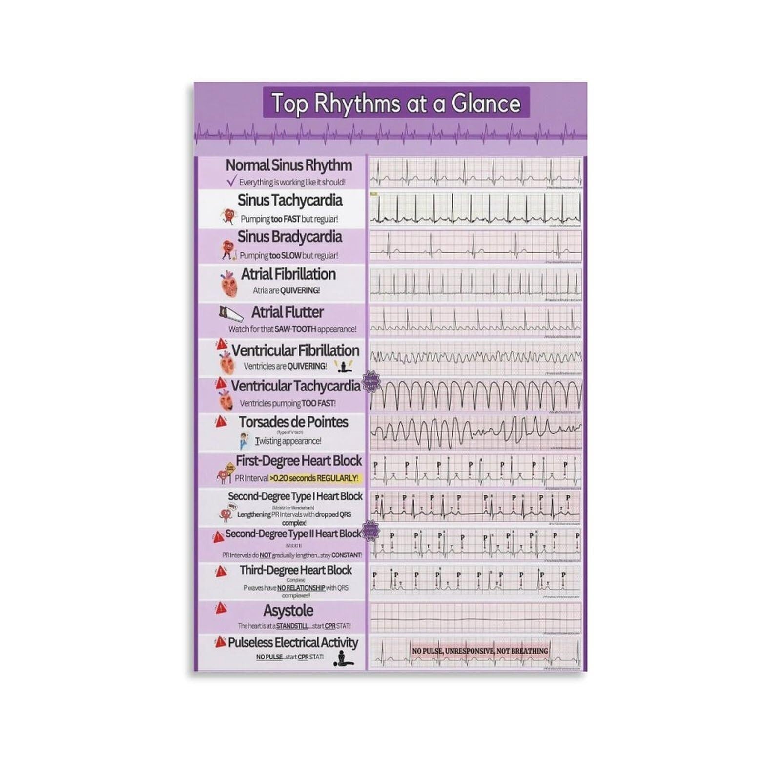 IDGTTLDF EKG ECG Rhythm Recognition Chart Arrhythmia Reference Guide for Nurses Paramedics EMT and Students Study Aid Unframed,08x12inch(20x30cm)