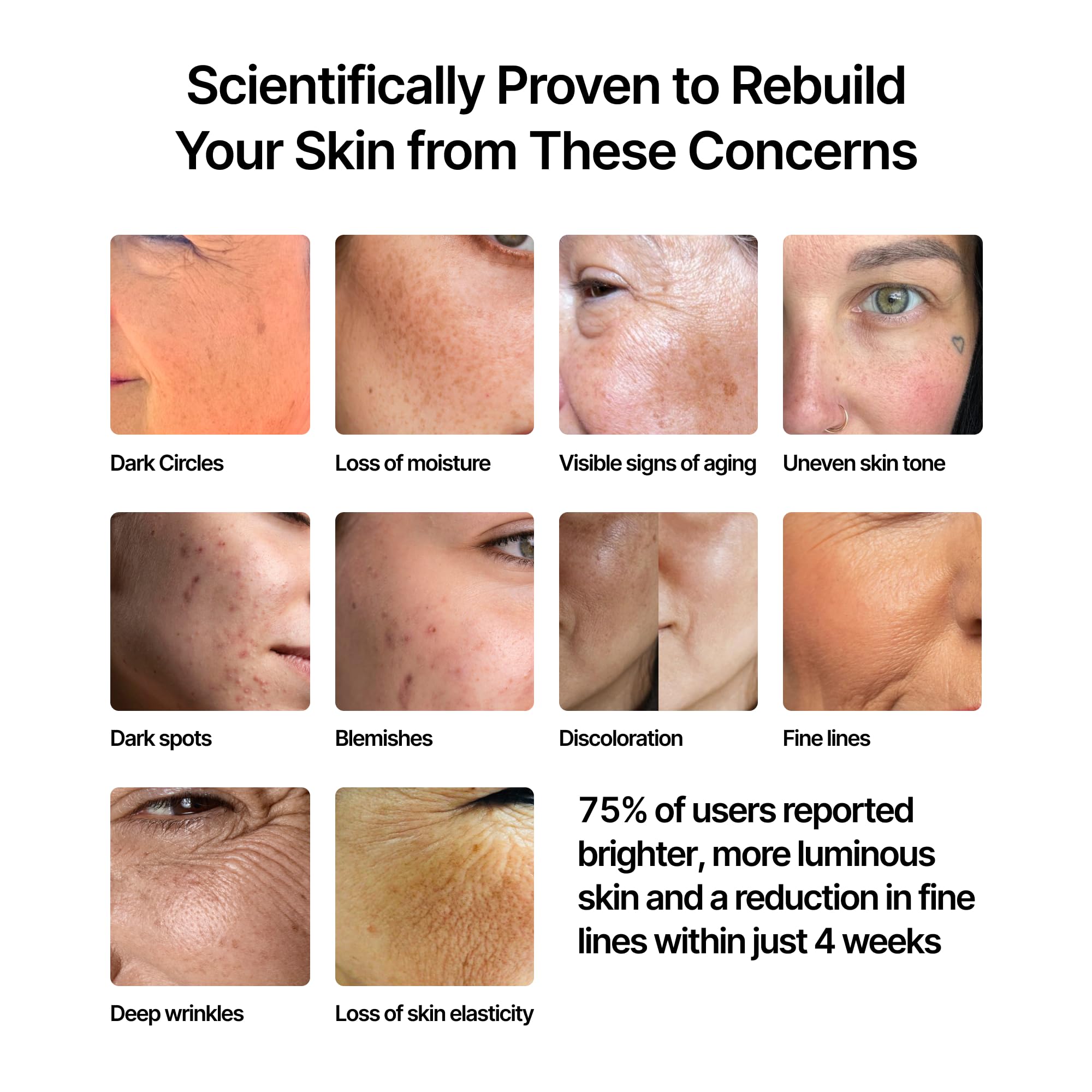 Amazon.com: GENIX Beauty Face Cream - Anti-Aging, Anti-Wrinkle