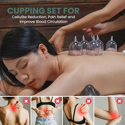 Miniatura 6 de ViVACious Kit de ventosas para terapia de masaje, juego de 24 tazas de terapia de masaje  Juego de terapia profesional de ventosas con herramienta