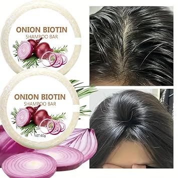 2 Pack Onion Shampoo Bar for Hair Growth, Onion and Rosemary Shampoo Bar for Hair Loss, Thinning Hair, Dry Damaged Hair, Hydrating Hair Soap Shampoo Bar for Hair Care