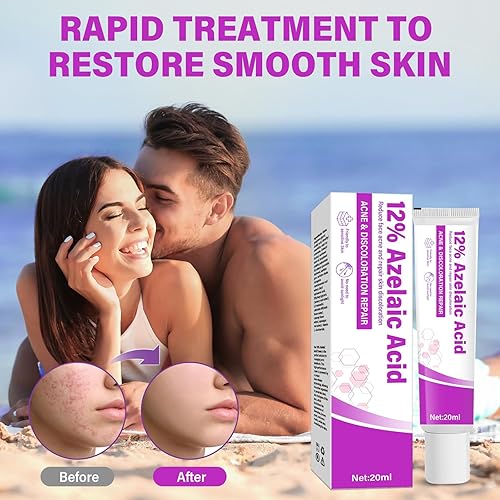 Miniatura 2 de Ácido azelaico, crema de suero de ácido azelaico al 12%, tratamiento de rosácea para cara, ácido hialurónico y niacinamida para aliviar el