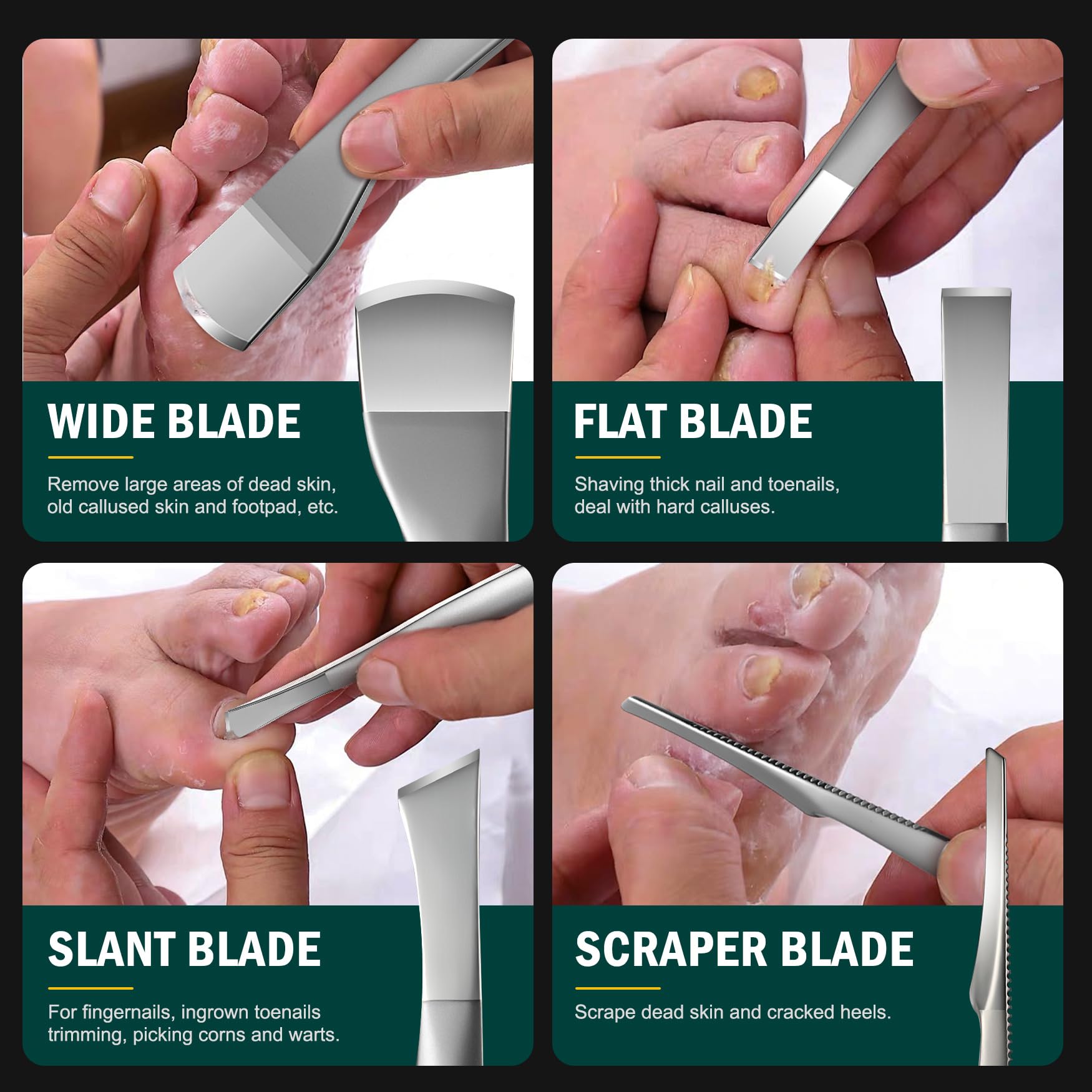 Juego de cuchillos de pedicura profesional, 4 piezas, kit de cuchillas de eliminación de uñas encarnadas, cuchillas de acero inoxidable para callos de los pies, color plateado 4