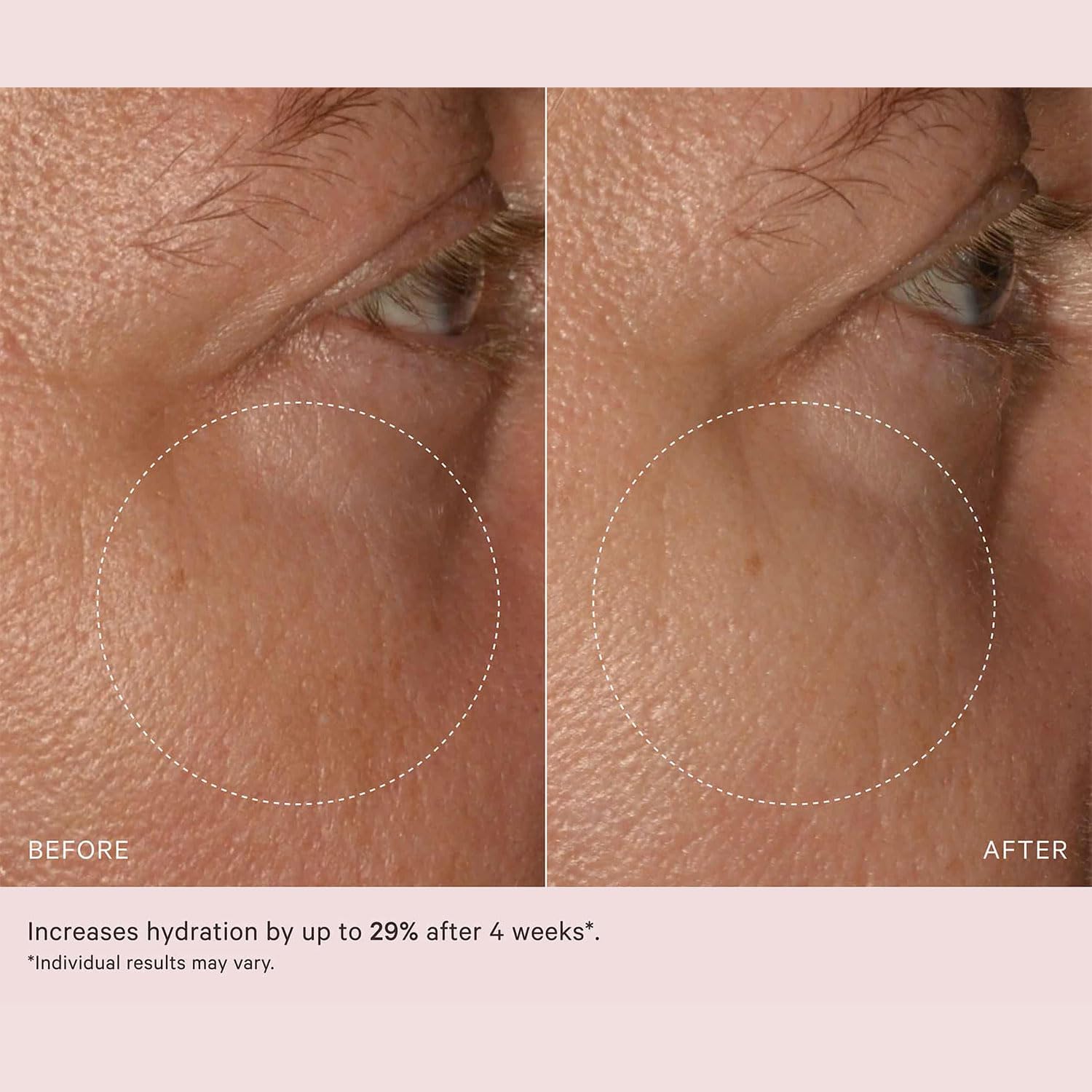 MZ SKIN Hydrate & Nourish Retinol Day Moisturizer 1.69 fl oz | Anti-Aging with SPF 30 | Including Hyaluronic Acid, Ceramides & Squalene | For Smoothing Fine Lines & Wrinkles & Brightening - Image 6