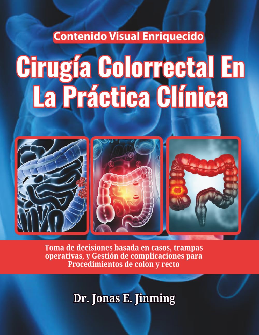 Cirugía Colorrectal En La Práctica Clínica: Toma de decisiones basada en casos, trampas operativas, y Gestión de complicaciones para Procedimientos de colon y recto