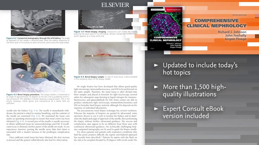 Comprehensive Clinical Nephrology: 9781455758388: Medicine