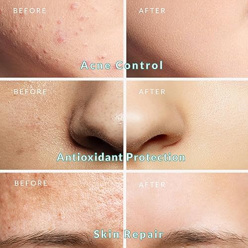 Miniatura 4 de PureNaturis Máscara orgánica de barro del Mar Muerto para cara y cuerpo, minimizador de poros de calidad de spa premium para acné, puntos negros,