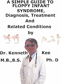 A Simple Guide to The Floppy Infant Syndrome, Diagnosis and Treatment and Related Conditions