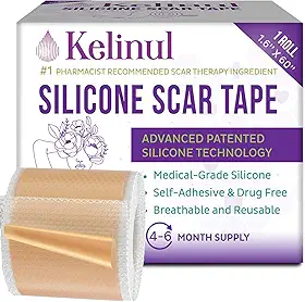 Fita de Silicone para Cicatrizes, Fita de Gel de Silicone Reutilizável, Tiras de Silicone de Grau Médico para Cirurgia, Cesárea, Quelóide, Queimadura e Acne (1,6'' x 60'')
