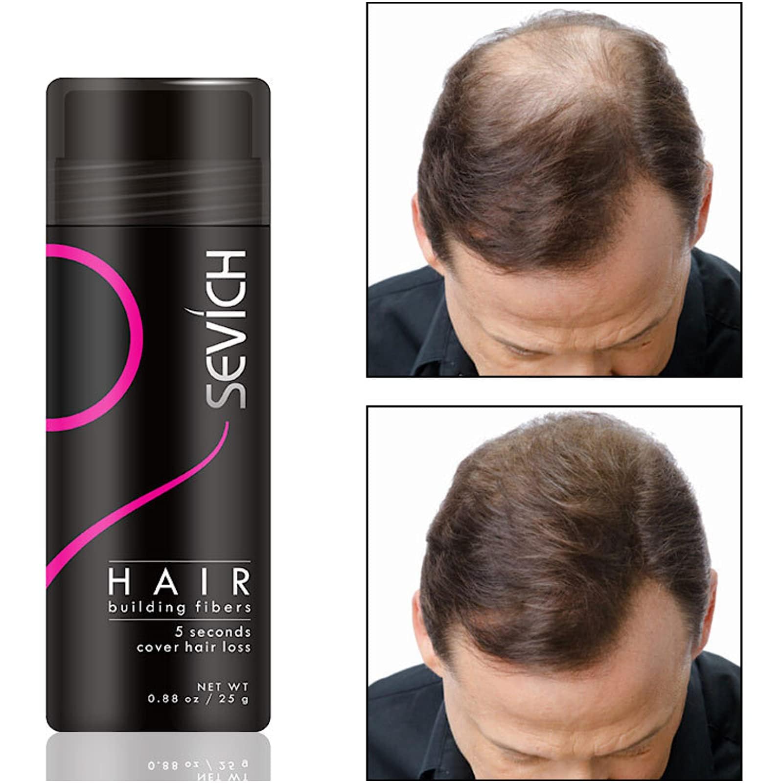 Włókna Włosów - Ukryj łysienie Natychmiast - 100% Naturalna Bawełna Proszek z Mikrofibry dla Mężczyzn i Kobiet (Średni Blond 25g)
