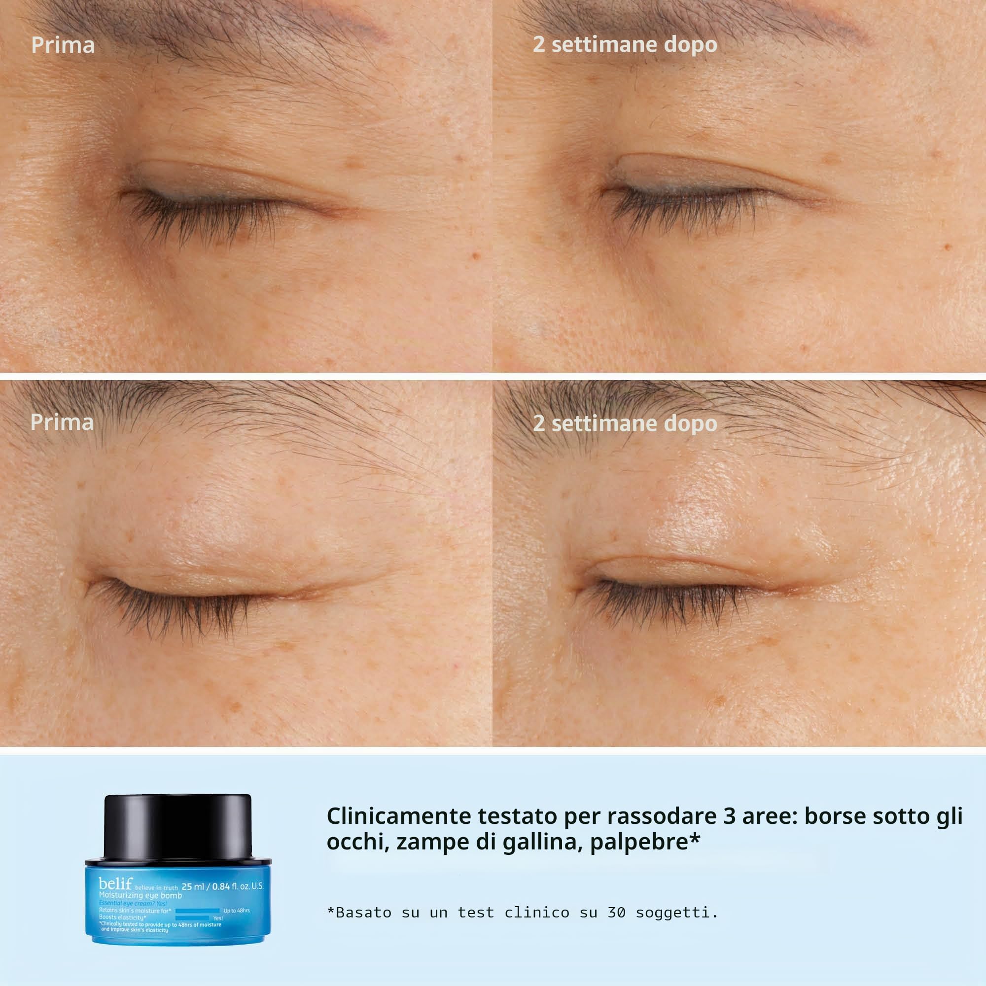 Belif Moisturizing Eye Bomb 25ml I Alle Erbe Delicate Occhi I Elasticità, Lenitiva, Idratante I Riduce Rughe, Occhiaie Antietà I Foglia Di Consolida, Erba Di Tigre
