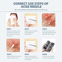 Vista 4 de JPNK Kit de eliminación de puntos negros, comedones y acné