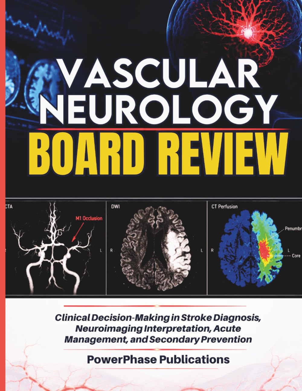 Vascular Neurology Board Review: Clinical Decision-Making in Stroke Diagnosis, Neuroimaging Interpretation, Acute Management, and Secondary Prevention