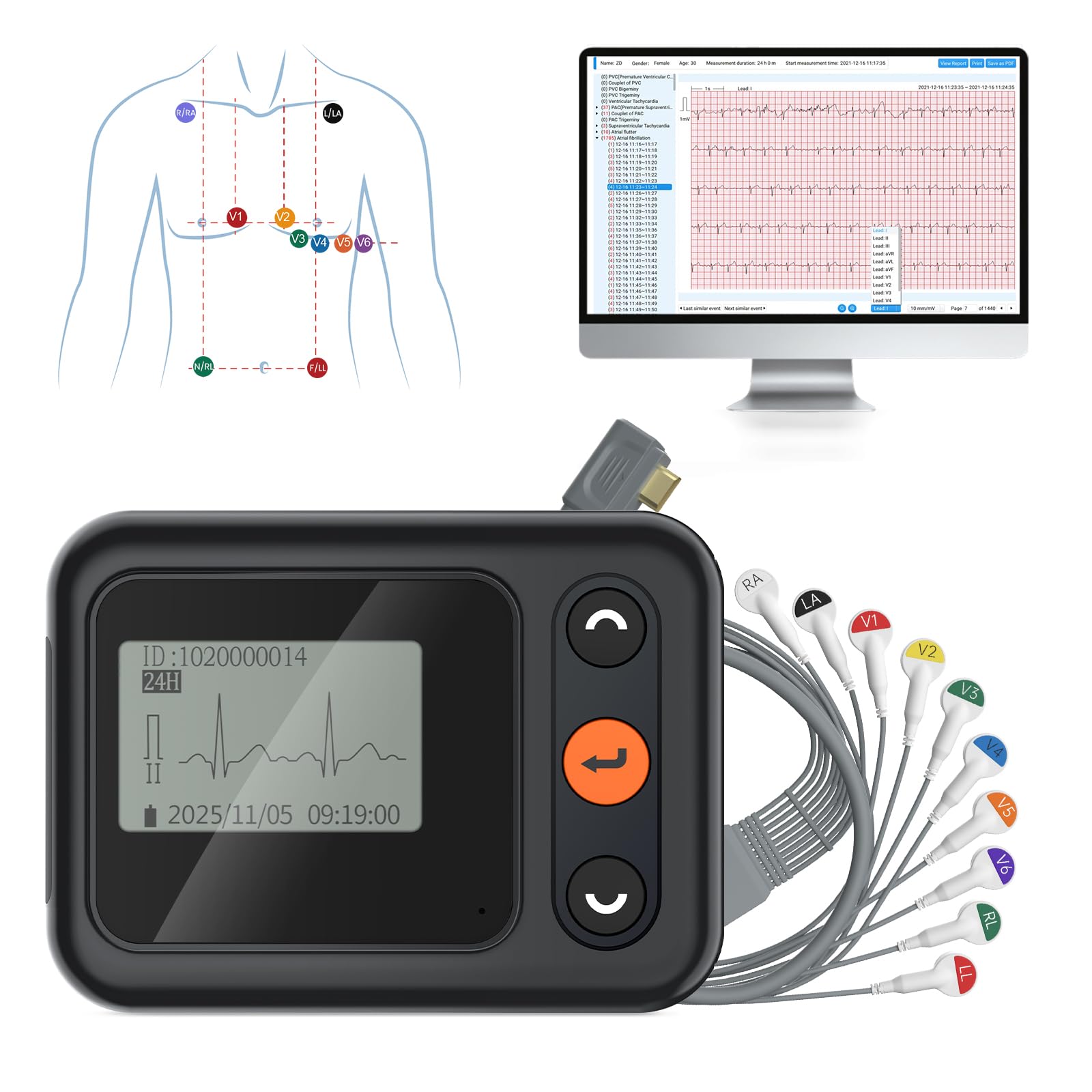 CheckMe 2026 ECG Aggiornato per Casa & ECG 12 Derivazioni – Analisi IA Potente e Registrazione Completa 24h: Monitor Holter Portatile per Monitoraggio Cardiaco Continuo con Software PC/Mac