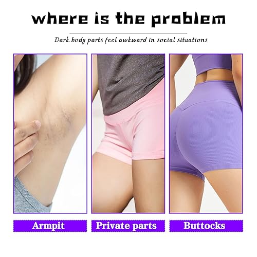 Miniatura 6 de Géneric 2024 Nuevo 2pcs 2.0 fl oz Crema Para Las Manchas De La Cara, Crema Para Manchas Oscuras En La Cara, Para Piel Entrepierna, Manchas Codos,