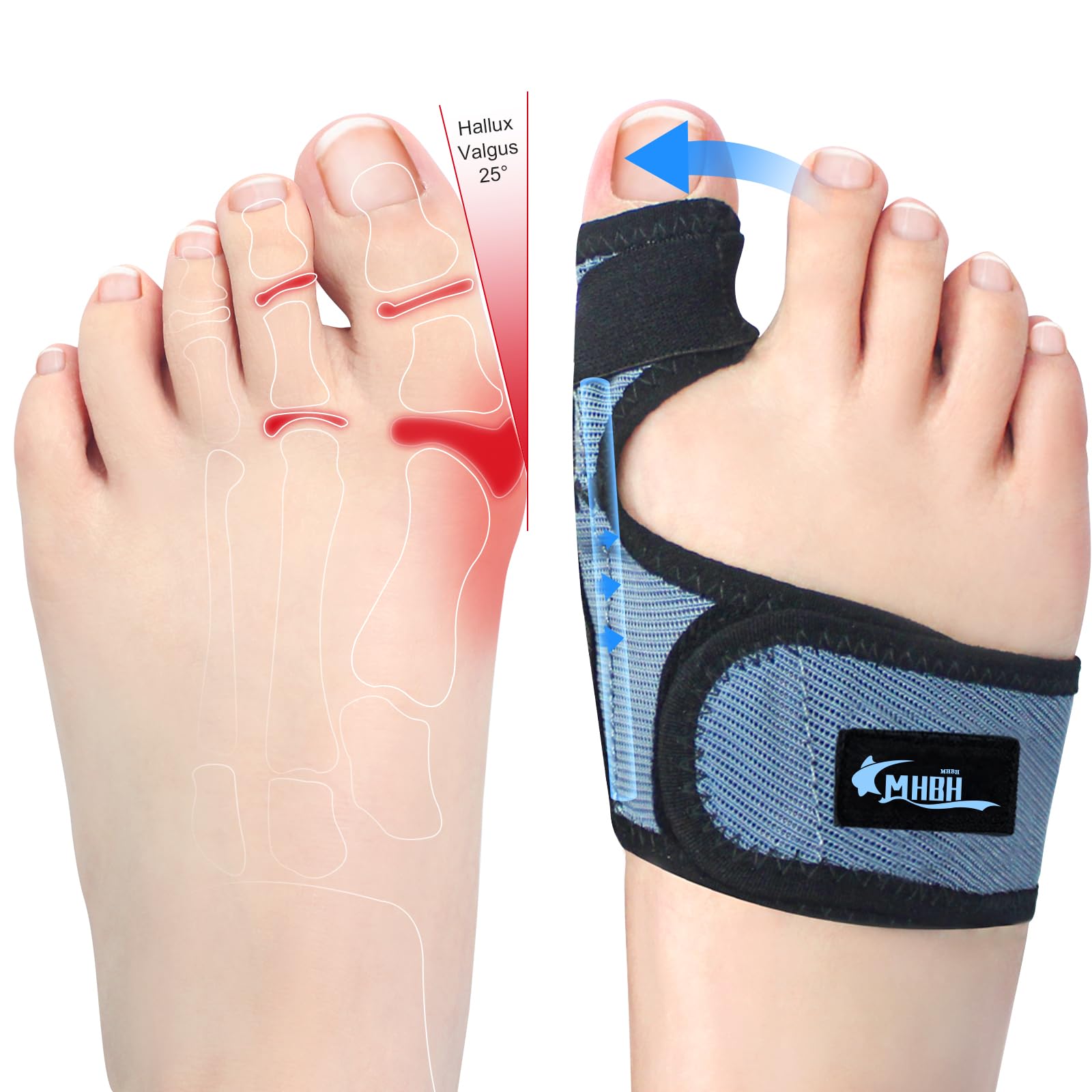 MHBHBunion Corrector for Women Men Big Toe, Breathable Mesh Adjustable Toe Separator, Toe Straightener Splint Brace for Bunion Relief, Hallux Valgus Pain Relief with 2 Kinds Correction Metal Sheet