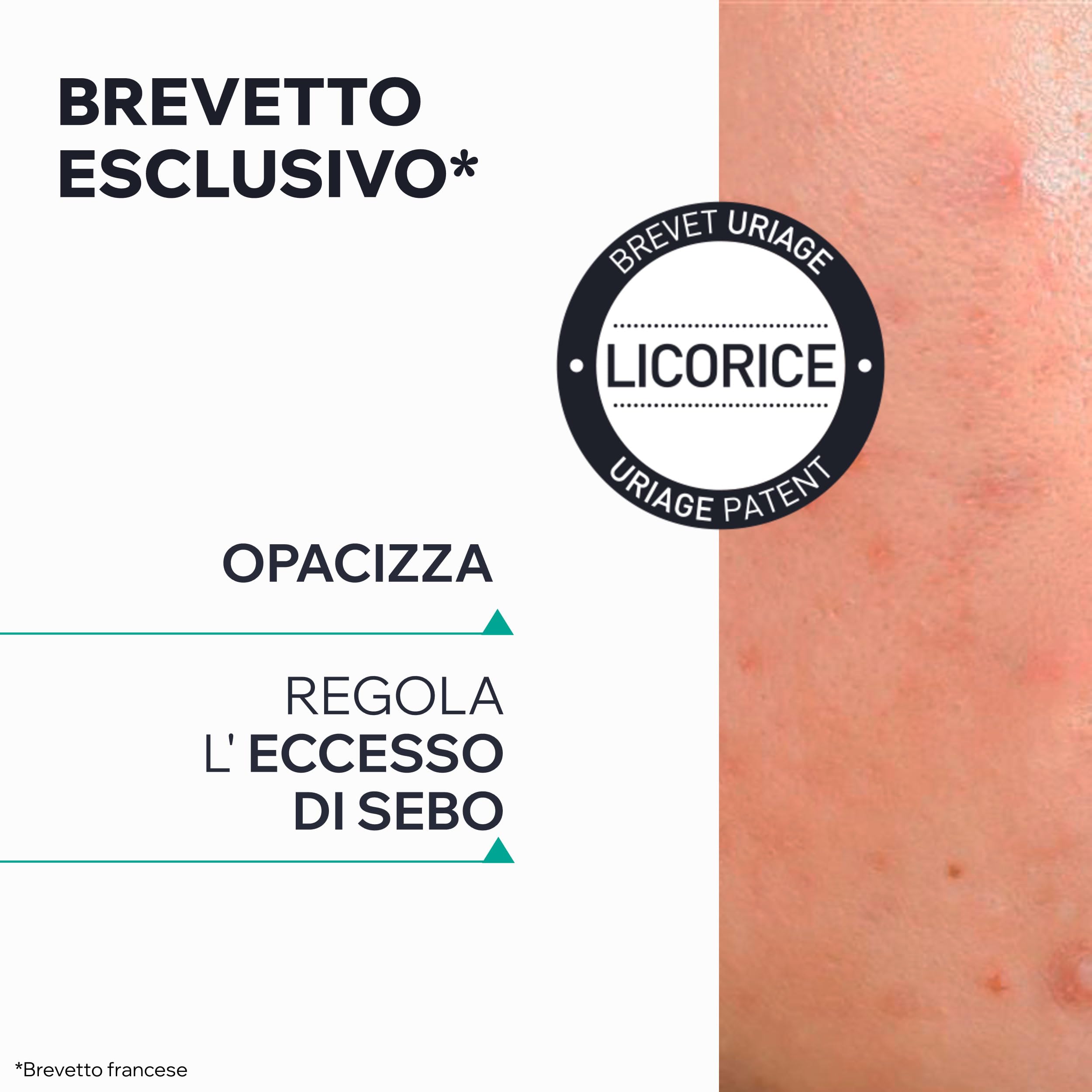 Uriage Hyseac Pasta SOS con Árbol del Té, Zinc y Arcilla Verde - Acelera la Maduración de las Imperfecciones de la Noche a la Mañana y Limita las Marcas en la Piel - Para Granos e imperfecciones.