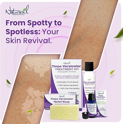 Miniatura 2 de Naturasil Natural Treatment Tinea Versicolor - Jabón 10 de azufre  También ayuda a aliviar la candida y la onicomicosis  Barra de 4 onzas  Paquete