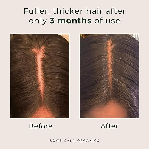 Miniatura 7 de Rowe Casa Organics Spray Natural Restaurador para el Cabello con Avellana y Aceites Esenciales Terapéuticos, Volumizador para el Cabello Hecho a