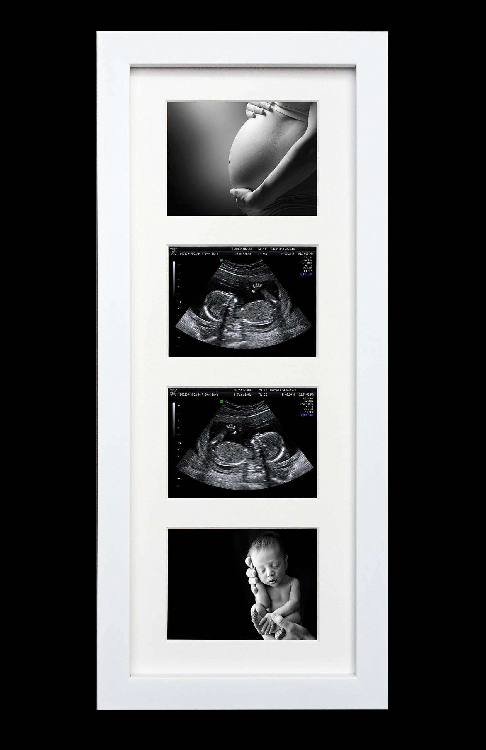 Pregnancy Ultrasound Sonogram Scan 1st Photo Hand Made 4 Aperture White Gloss Frame