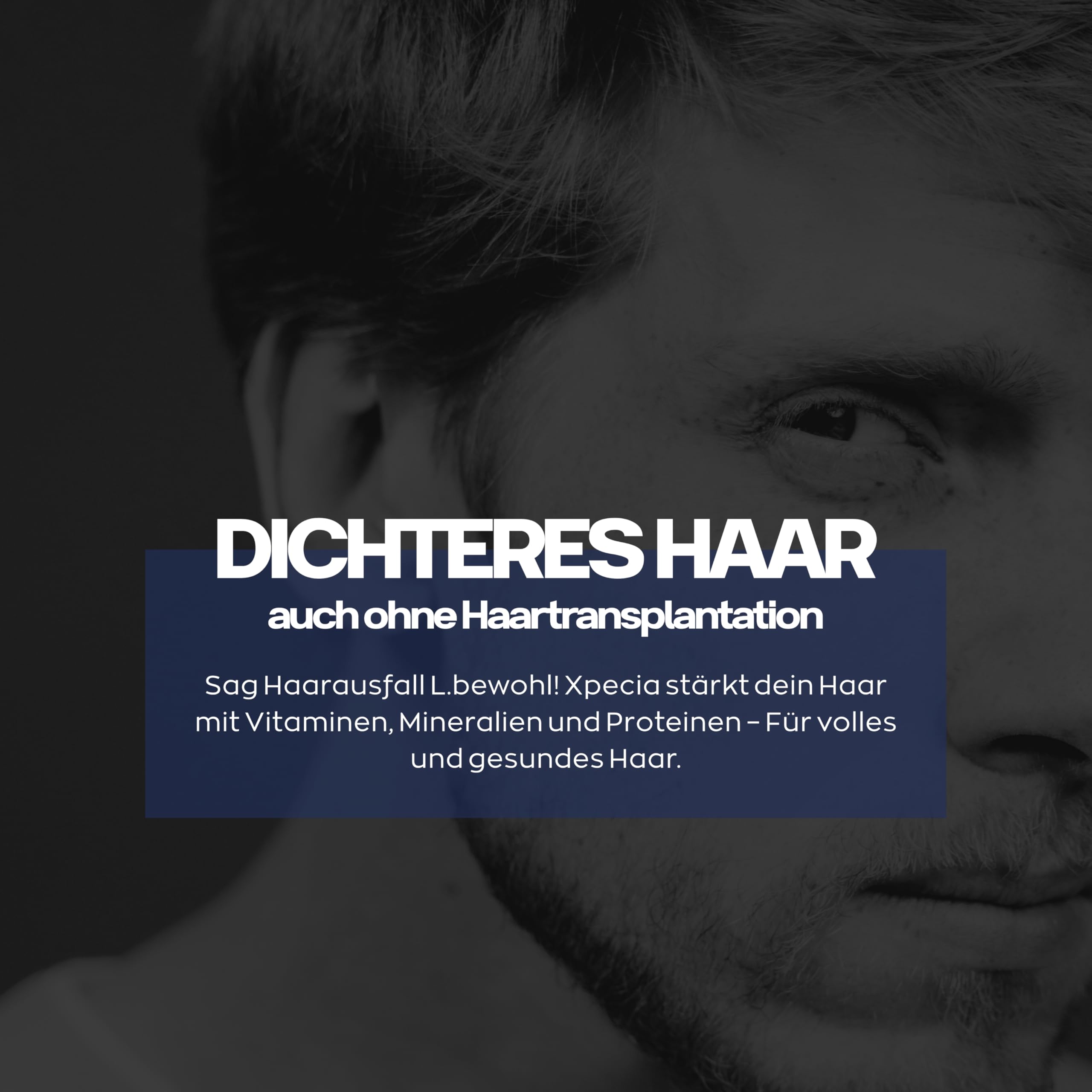Xpecia DHT Blocker mit Biotin und Sägepalmextrakt - Gegen Haarausfall Männer - Ginko Wurzel, Haar Vitamine, Sägepalme - Haarwachstum beschleunigen - Nachbehandlung Haartransplantationen