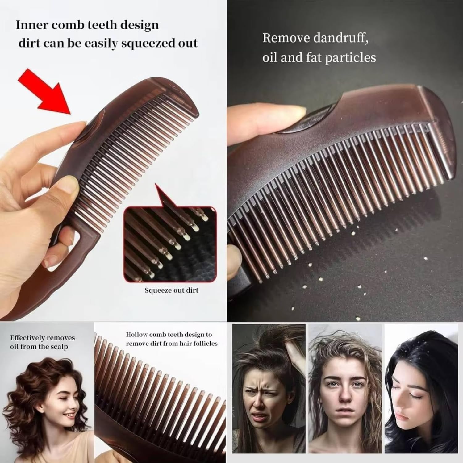 Radhav Mart design of dandruff comb, energy massage, beauty, healthier scalp, better hair quality for women and men to remove dandruff and dirt 1