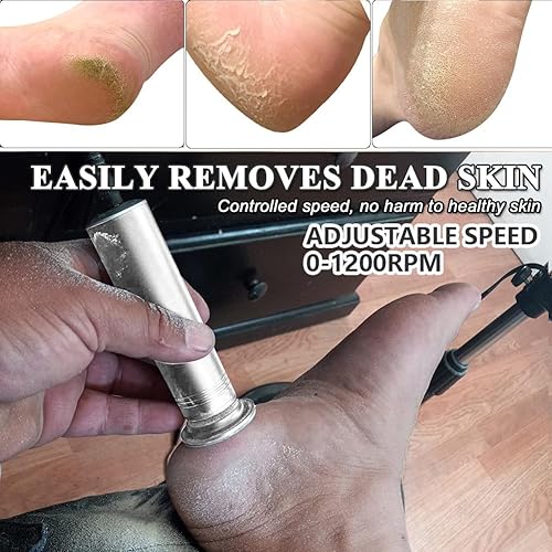 Miniatura 3 de Removedor de callos eléctrico mejorado para pies, 1200 rpm, velocidad ajustable, lima eléctrica profesional para pies, pedicura, lijadora de pies