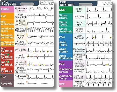 EKG Rhythm Interpretation Badge Card Nursing Telemetry Reference Guide