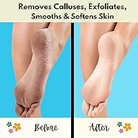 Vista 2 de Mr. Pumice Callus Remover PUMI Bar: Pedicure Stone & Foot/Heel Scrubber - Medium Grit (Assorted Colors) 4 Pack