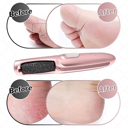 Miniatura 5 de Potente varita eliminadora eléctrica de callos Lima de pies, amoladora y depuradora recargable, elimina la piel muerta, dura y callos La mejor