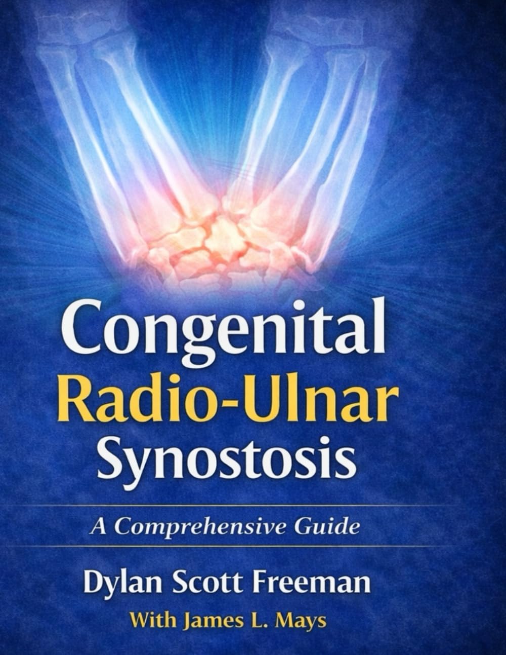 Congenital Radio-Ulnar Synostosis: A Comprehensive Guide