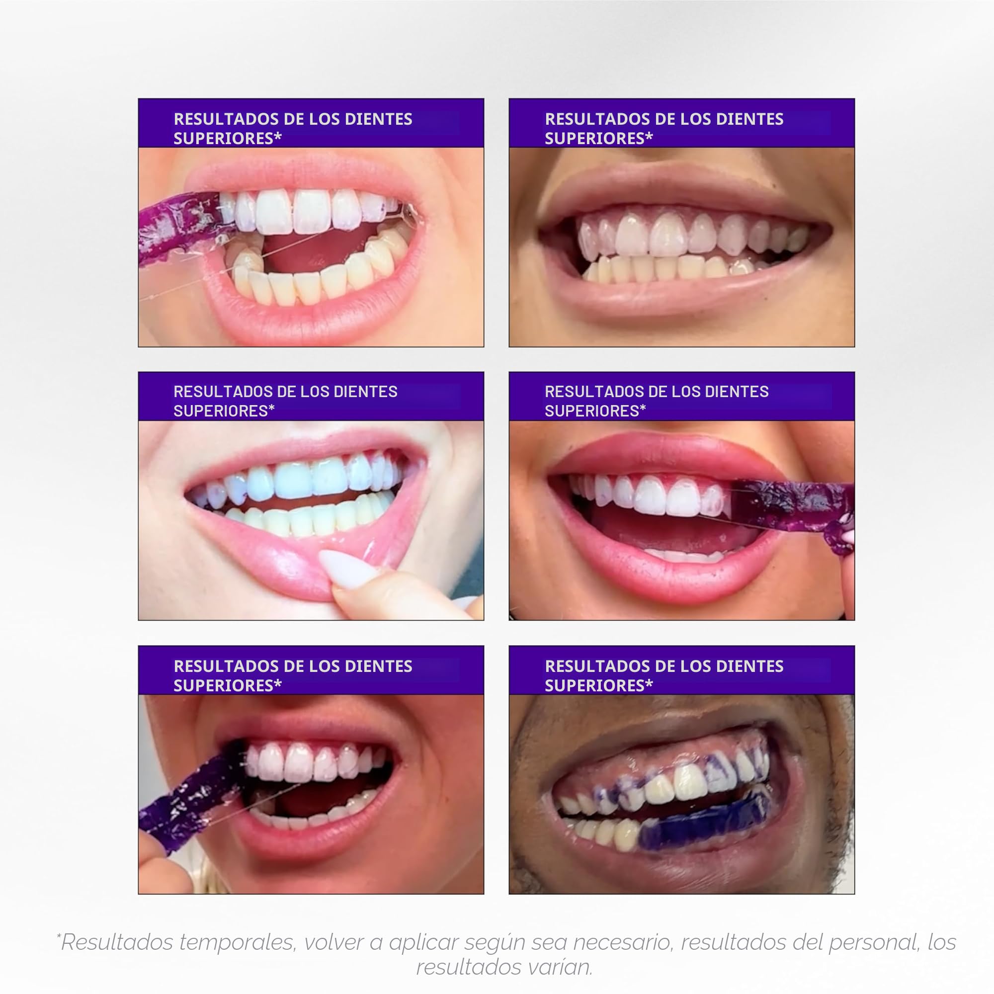 Hismile V34 Tiras blanqueadoras, blanqueamiento dental, blanqueamiento dental morado, tratamiento de manchas dentales, 14 unidades (paquete de 14)