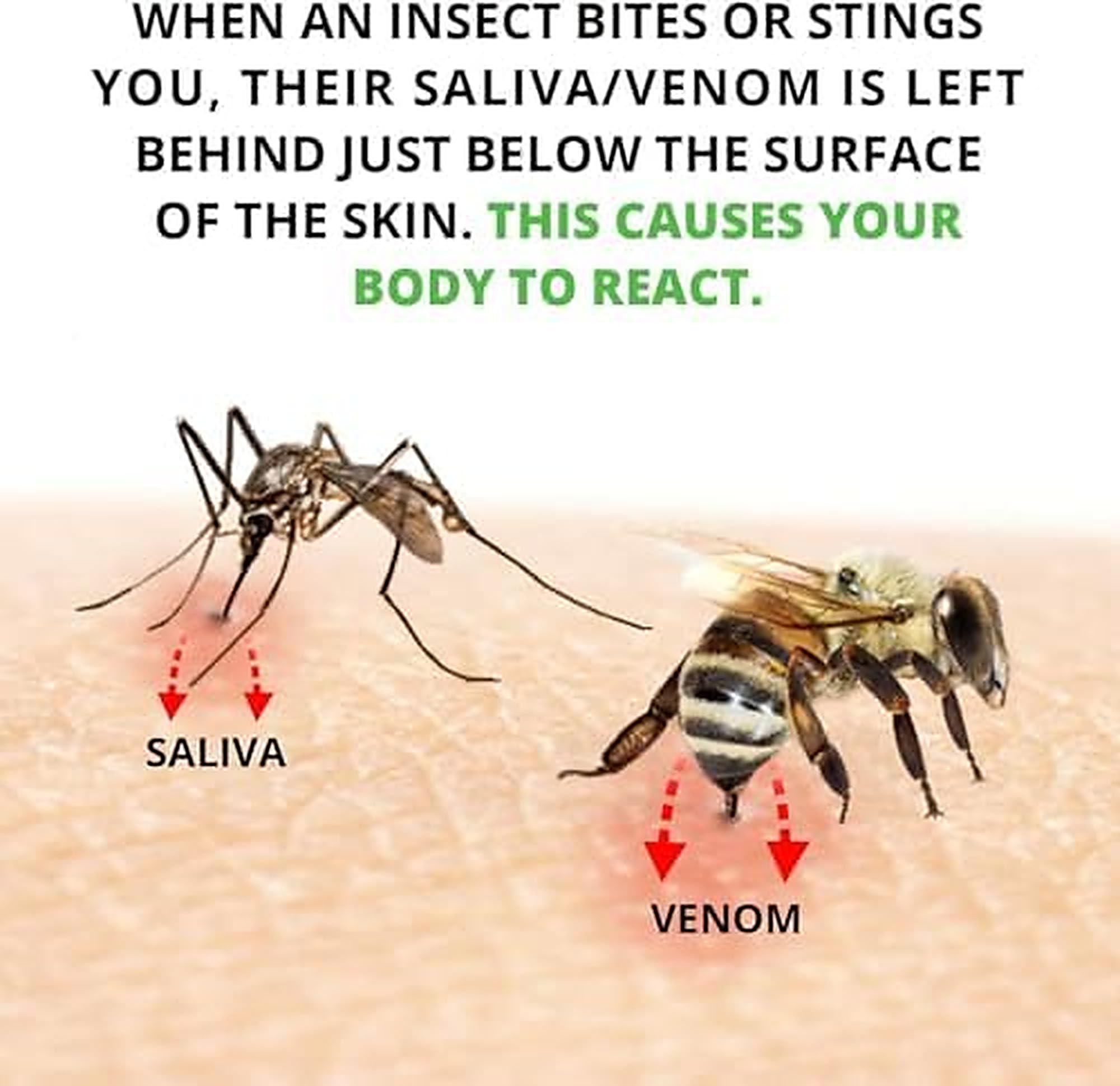 BUG BITE THING® L'originale dal 1983 | Strumento di aspirazione riutilizzabile senza sostanze chimiche | Dopo punture di zanzare, api e vespe | In caso di prurito causato da morsi
