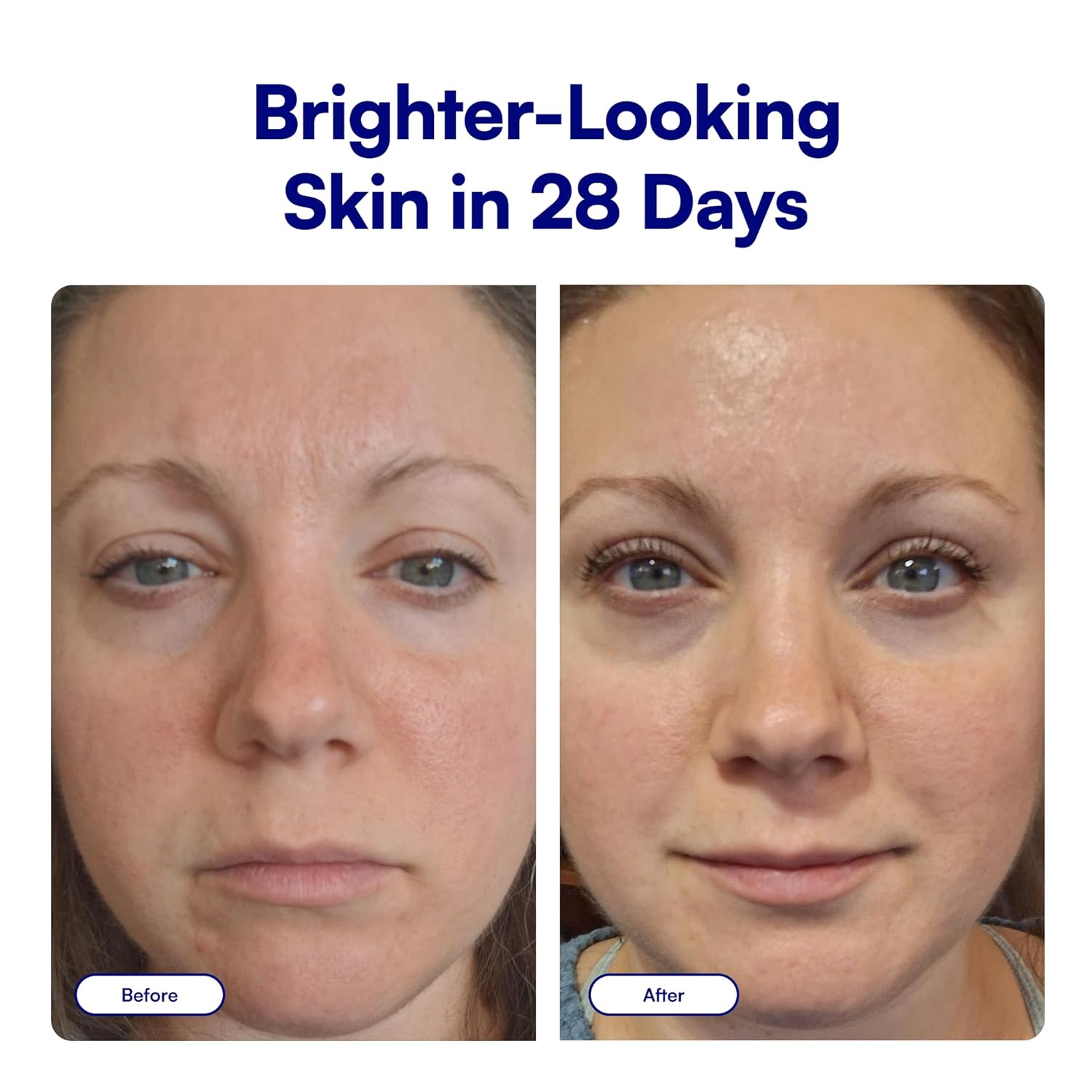 Bliss Vitamin C + Tri-Peptide Bright Idea Serum – 15% Brightening + Barrier Boost Complex for Radiant, Firm Skin – Anti-Aging Face Serum Boosts Collagen & Elasticity - 1 fl oz - Image 2