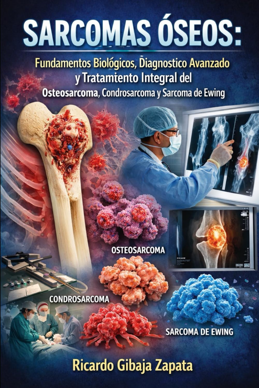 Sarcomas Óseos Fundamentos Biológicos, Diagnóstico Avanzado y Tratamiento Integral del Osteosarcoma, Condrosarcoma y Sarcoma de Ewing