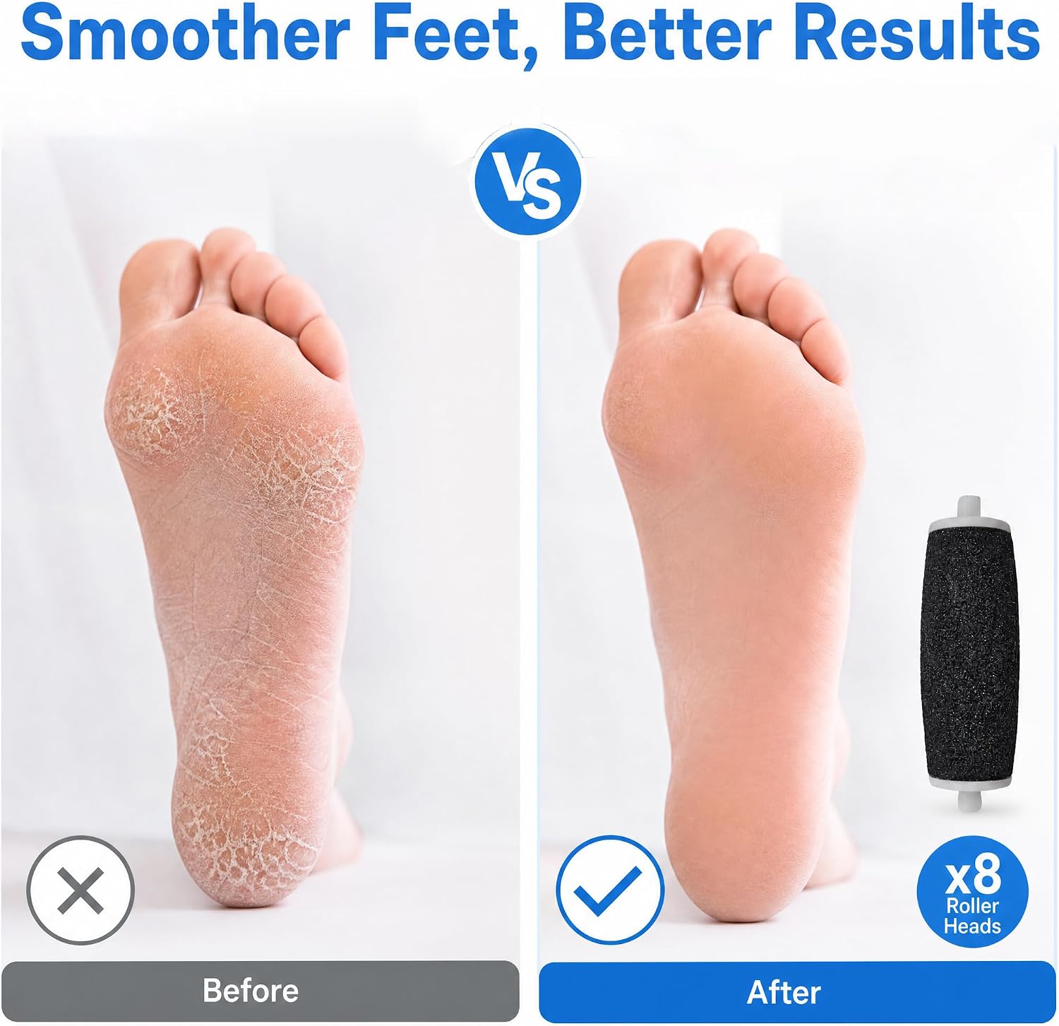 8 Pcs Extra Coarse Foot File Replacement Roller Heads, Black | Hard skin remover refills for most electronic foot files; extra coarse rollers for men and women